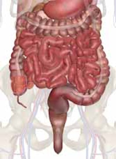 Intestines