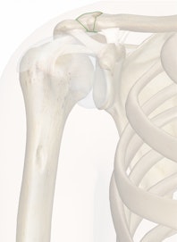 The Acromioclavicular Ligament