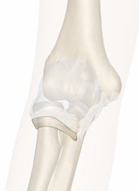 Annular Ligament of Elbow