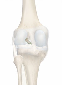 Anterior Cruciate Ligament
