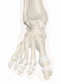Anterior Talofibular Ligament