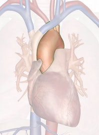 Arch of Aorta