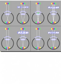 Astigmatism