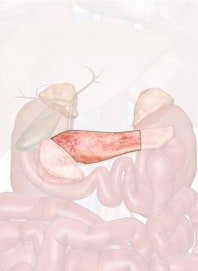 Body of Pancreas