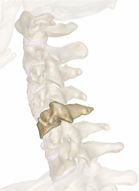 C5 (5th Cervical Vertebra)