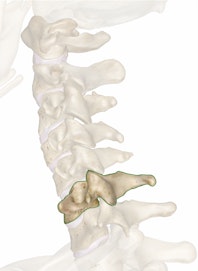 The C6 Vertebra