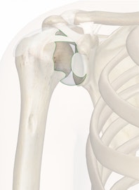 Capsular Ligament of the Shoulder