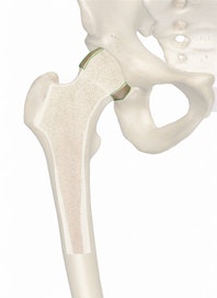 Cartilage