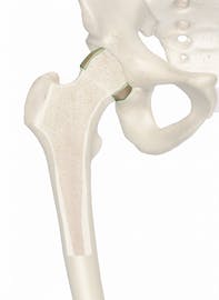 Cartilage