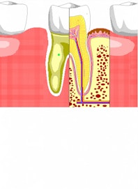 Cementum Layer over Root