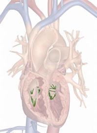 The Chordae Tendineae