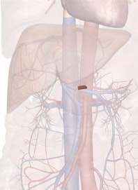 Common Hepatic Artery