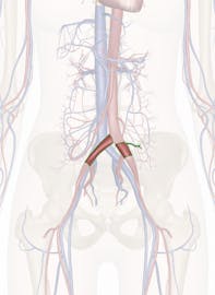 Common Iliac Artery