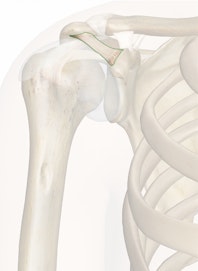Coracoacromial Ligament