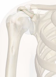 Coracoacromial Ligament