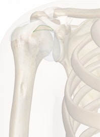 Coracohumeral Ligament