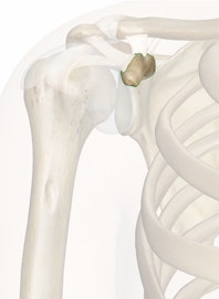 Coracoid Process of Scapula