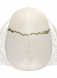 Coronal Suture