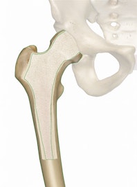 Cortical (Compact) Bone
