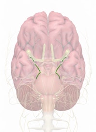 Cranial Nerve IV - Trochlear Nerve