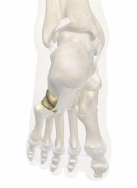 Cuboid Bone