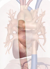 Descending Aorta