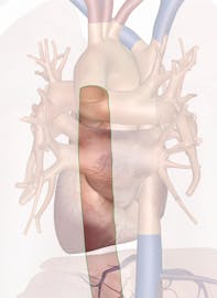 Descending Aorta