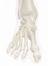 Dorsal Tarsometatarsal Ligaments