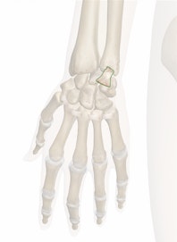 Dorsal Ulnocarpal Ligament