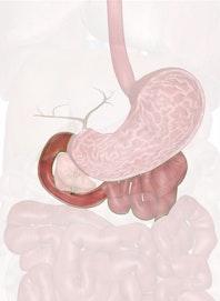 The Duodenum