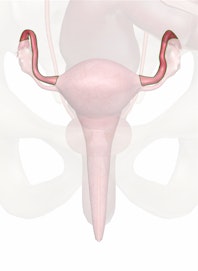 Fallopian Tube