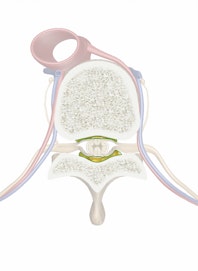 Fat in Epidural Space