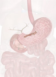 Gastric Canal