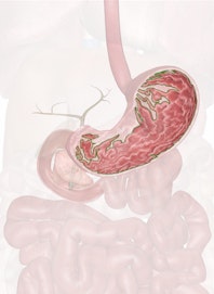Gastric Folds