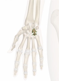 Hamate Bone