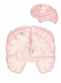 Head (Sensory)