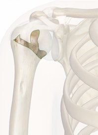 Head of Humerus