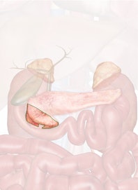 Head of Pancreas