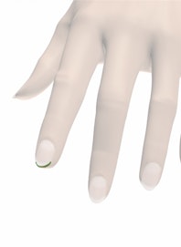 Hyponychium of Fingernail