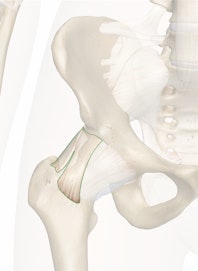 The Iliofemoral Ligament