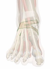 Inferior Extensor Retinaculum