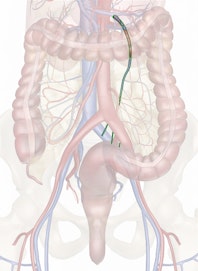 Inferior Mesenteric Vein
