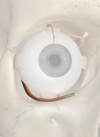 Inferior Oblique Muscle