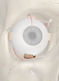 Inferior Rectus Muscle