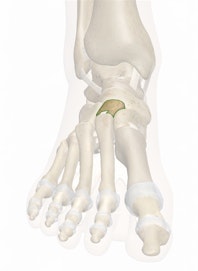 Intermediate Cuneiform Bone
