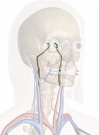 Internal Carotid Artery