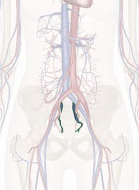 Internal Iliac Vein