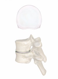 Intervertebral Discs