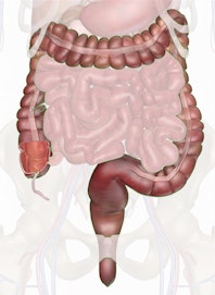 The Large Intestine