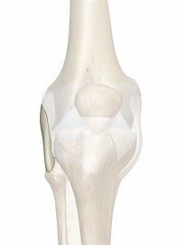 Lateral Collateral (Fibular Collateral) Ligament